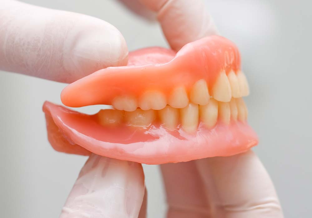 入れ歯（義歯）