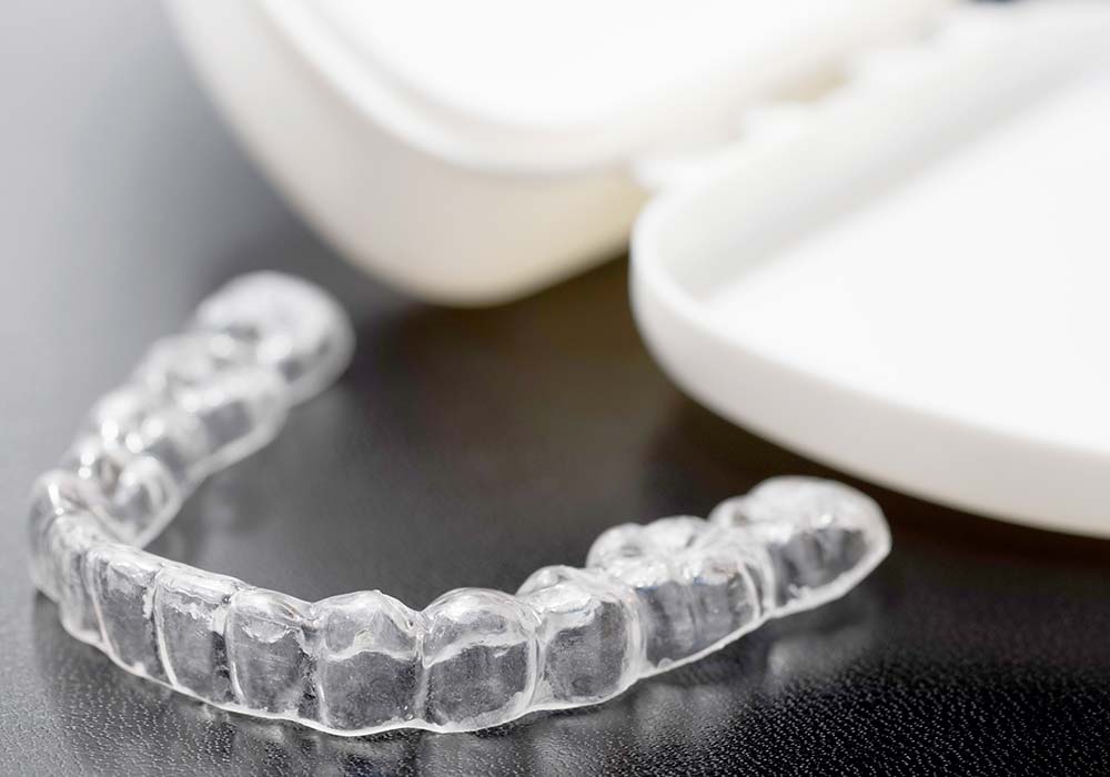 各種マウスピース製作