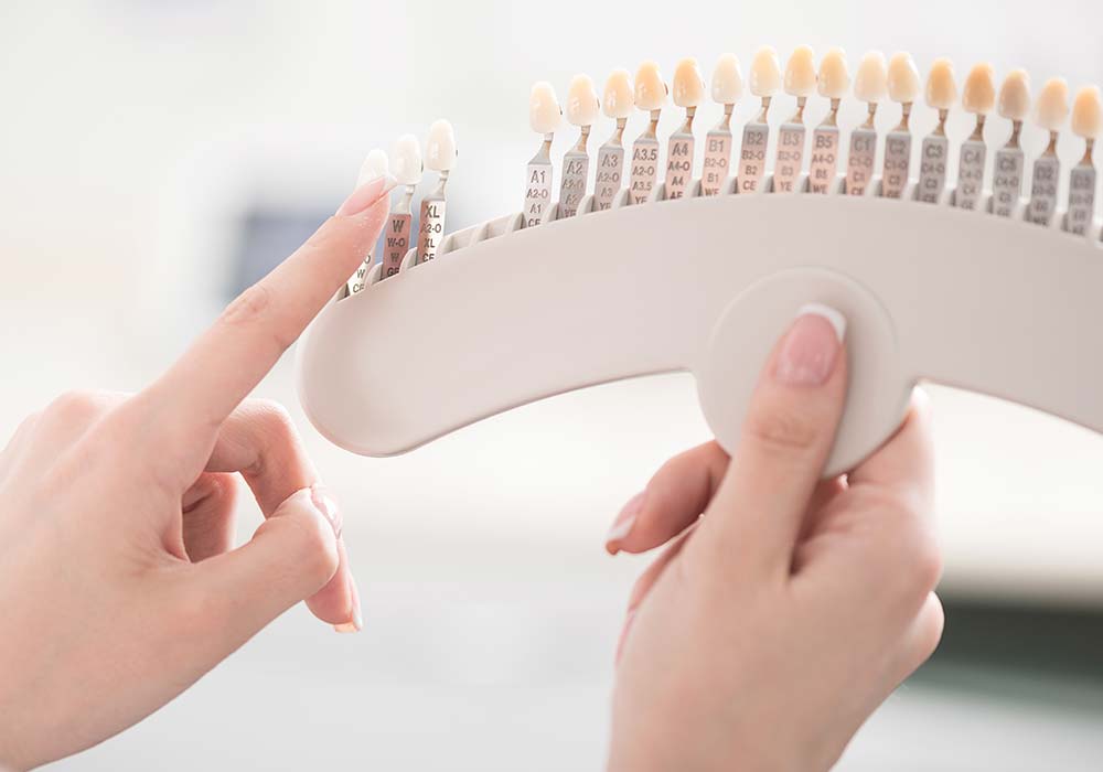 ホワイトニング